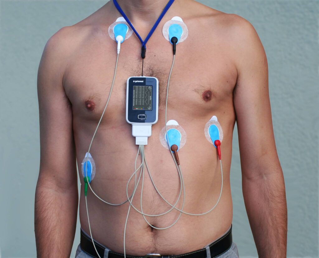 holter monitor